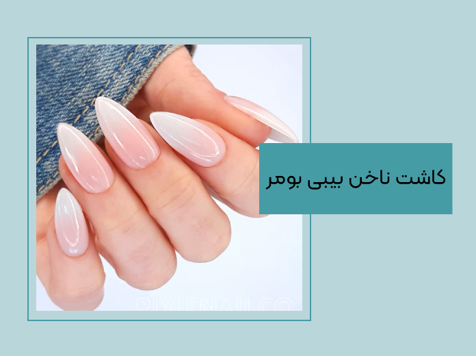 کاشت بیبی بومر