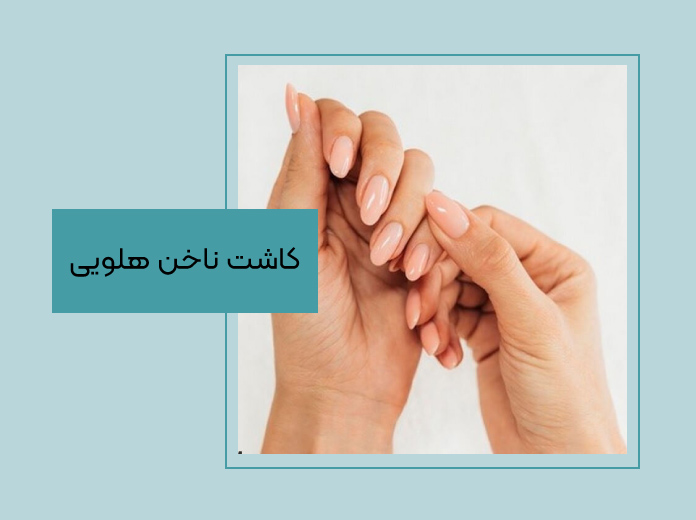 کاشت هلویی