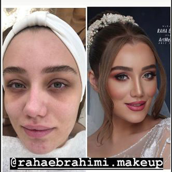 آرایش پوست جوش دار میکاپ صورت آکنه دار