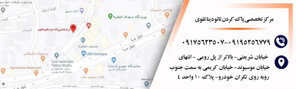 آدرس-مرکز-تخصصی-پاک-کردن-تاتو-دینا-تقوی